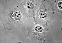 Three medicinal herbs native to Saudi Arabia discovered to hold powerful anti-cancer properties