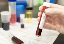 Family tests positive for HIV after mom keeps diagnosis secret