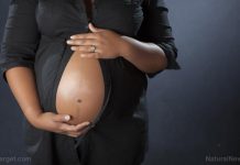 ADHD drug use has skyrocketed 345% among young women in 12 years according to the CDC, increasing birth defects
