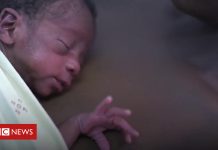 How Malawi reduced infant mortality