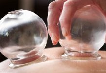 Cupping therapy from ancient Traditional Persian Medicine found to improve quality of life