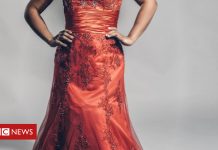 Down's model makes strides on catwalk