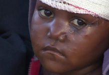 DR Congo massacre: 'My daughter was slashed with a machete'
