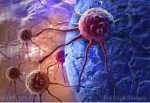 Breast cancer drug lapatinib ACCELERATES cancer cell growth, concludes new study